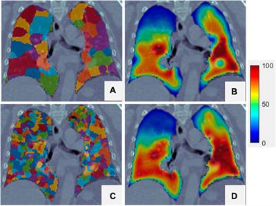 A super-voxel-based method for generating surrogate lung ventilation images from CT